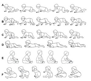 Figura 2. Ejemplos de estilos de gateo. A. Gateo estndar: el nio gatea con manos y rodillas. Brazo izquierdo y pierna derecha o brazo derecho y pierna izquierda se mueven a la vez. B. Gateo del oso o gateo con manos y pies: el patrn de movimiento y balanceo es el mismo que A, pero el nio inicia la postura con el pie y no con la rodilla. C. Mezcla paso-gateo: el nio utiliza el pie izquierdo y la rodilla derecha. la pierna izquierda inicia la postura apoyando el pie izquierdo. El brazo izquierdo y pierna derecha se balancean juntos y la pierna derecha retoma la postura con la rodilla derecha. El balanceo del brazo derecho y pierna izquierda terminan con la postura del pie izquierdo. D. Pecho a tierra: el desplazamiento ocurre manteniendo el ombligo en contacto con el suelo. Mientras el brazo izquierdo y el pie derecho realizan el balanceo, la pierna izquierda se extiende para empujar el suelo para poder avanzar al frente a la vez y que tira para ayudar al arrastre con el brazo derecho. E.De Pompis: en posicin sentado, el nio utiliza la flexin de las rodillas y las piernas para impulsar el cuerpo hacia delante. F.Gateo de remo: el nio inicia el movimiento sentado sobre una pierna y la nalga del mismo lado (derecha segn el dibujo). Eleva la pelvis apoyndose en la mano (derecha) la rodilla del mismo lado y el pie de la pierna contraria. Apoyndose en el pie y la mano mueve la pierna que estaba apoyada en la rodilla y por fin balancea la pierna que apoyaba en el pie (la izquierda en este dibujo), para as regresar a la posicin de sentado y reiniciar el ciclo (Copiado de Oldak-Kovalsky B y col. Gateo. Revisin de la literatura).